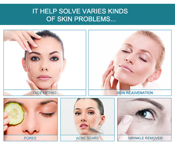 MR16-3S acne removal deep wrinkle removal facial rejuvenation improve wrinkle rf skin tightening skin rejuvenation beauty system